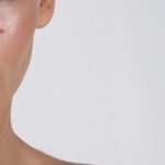 oily skin girl بشرة دهنية - حب الشباب
