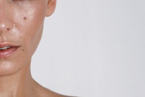 oily skin girl بشرة دهنية - حب الشباب