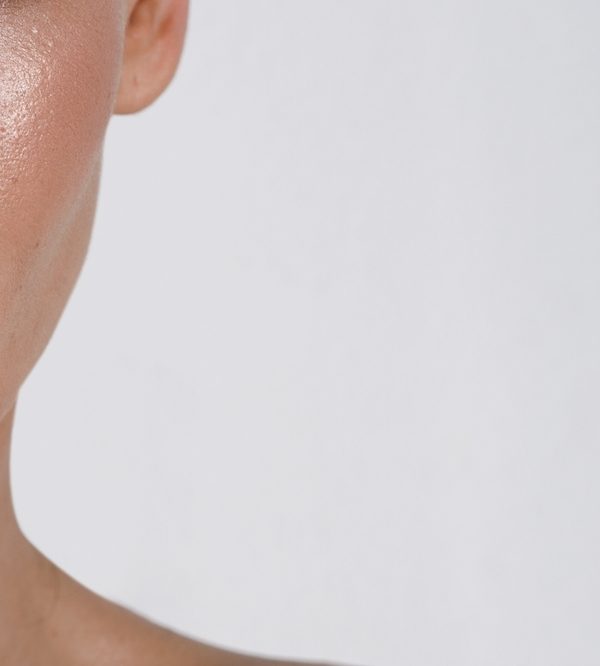 oily skin girl بشرة دهنية - حب الشباب