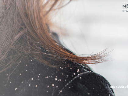 Anti Dandruff Shampoo for visible dandruff flakes on hair and shoulders