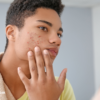 Teenager with acne-prone skin examining facial pimples in the mirror before using the best acne treatment gel for clearer-looking skin